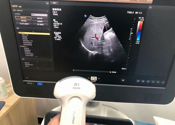 Philip C5-1 EPIQ 5 cihazı için karın tıbbi ultrason probu