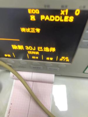 ZOLL M Serisi Defibrilatör Makinesi Parçaları Fakülte Tamir Servisi Perakende